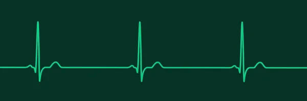 BAISSE DU RYTHME CARDIAQUE