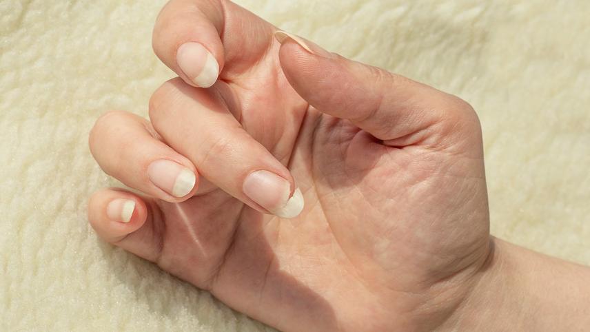 SOIN DES ONGLES CASSANTS